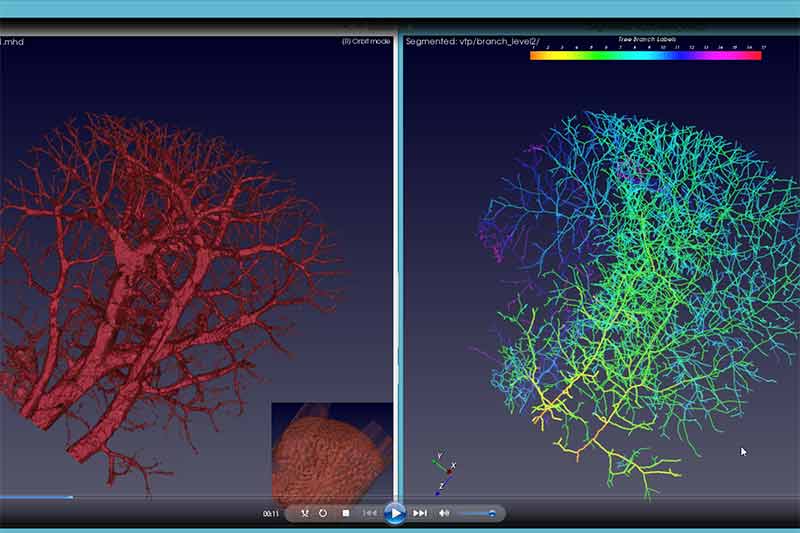 New software from Data61 could help in early cancer detection and improved treatment success rates